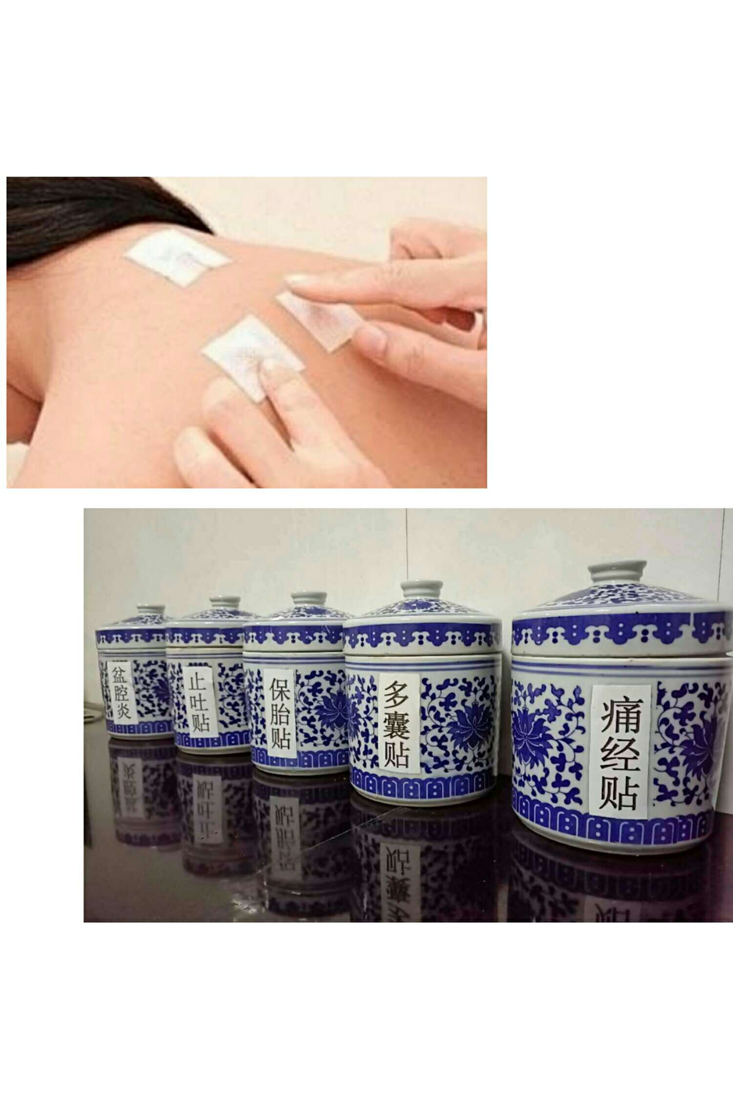 1、三伏貼能治什么?。? style=