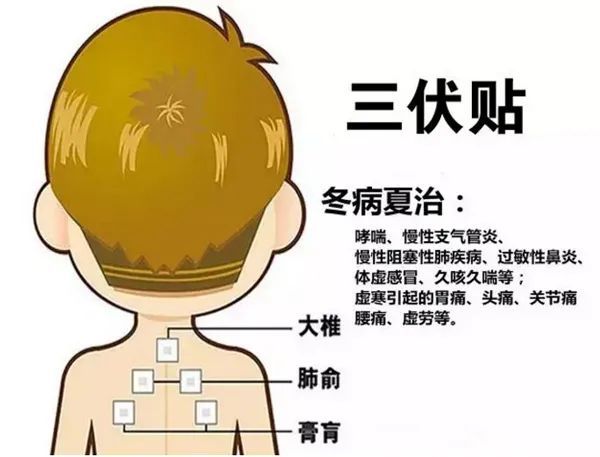 2、三伏貼的功能和功效是什么？