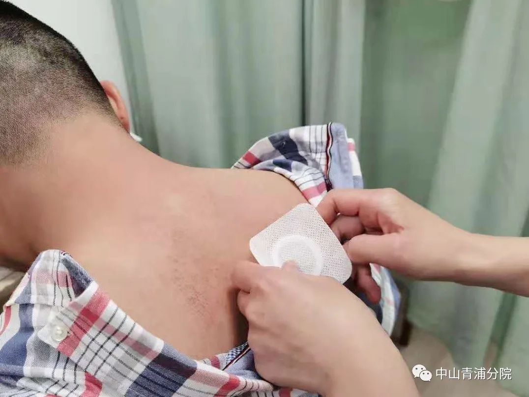 2、江西兒童貼三伏貼癢灼痛，什么體質(zhì)的人可以貼三伏貼癢灼痛？