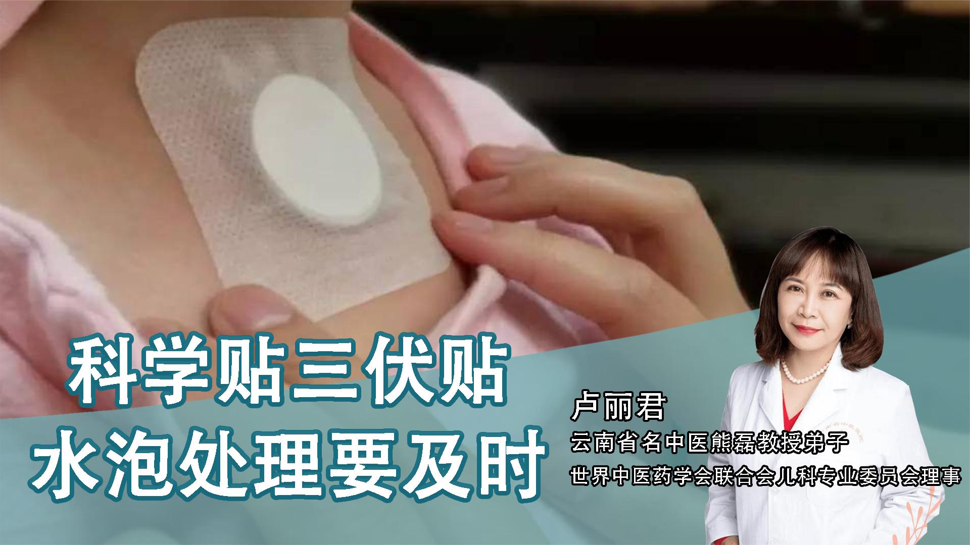 2、貼三伏貼后有什么禁忌？