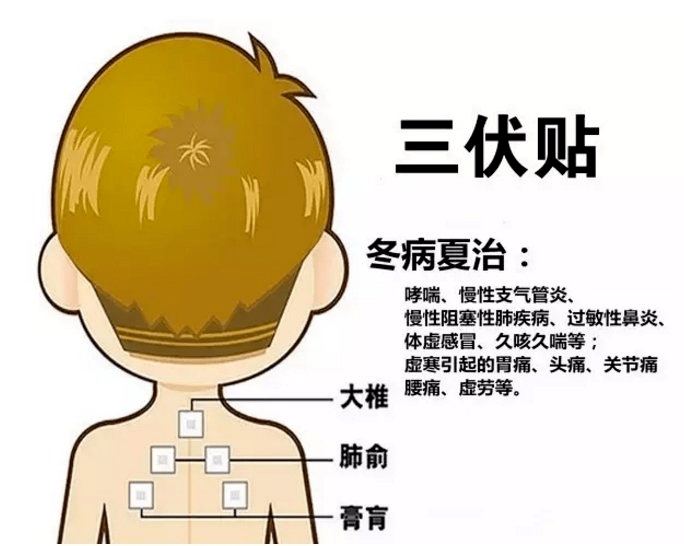 1、三伏貼多大？寶寶能貼多少？</p><p>三伏貼孩子貼多久？