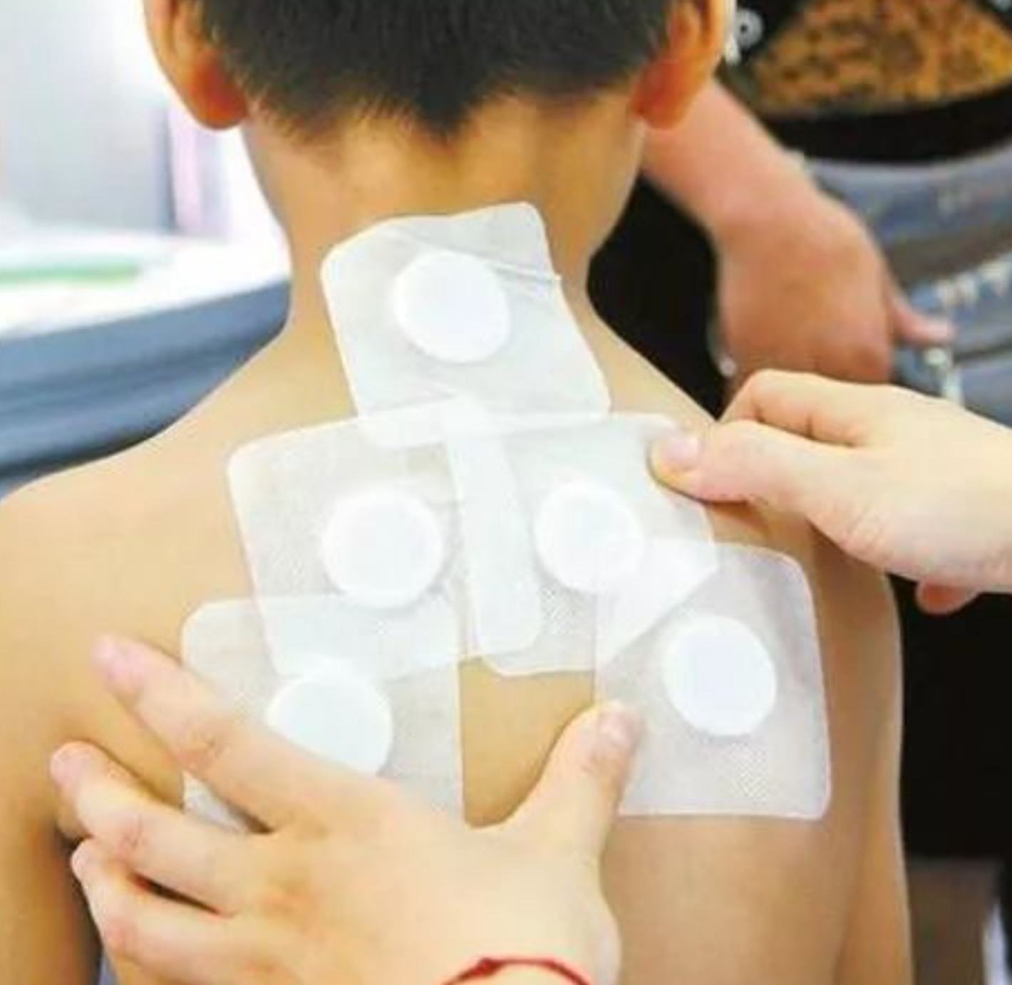 2、三伏貼在脖子上，有一根針，看起來很疼。怎么了